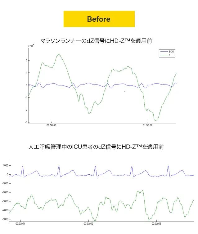 HD-Z™フィルターの適用前