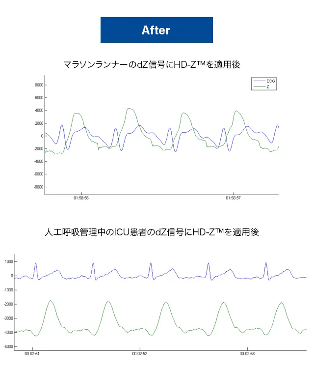 HD-Z™フィルターの適用後