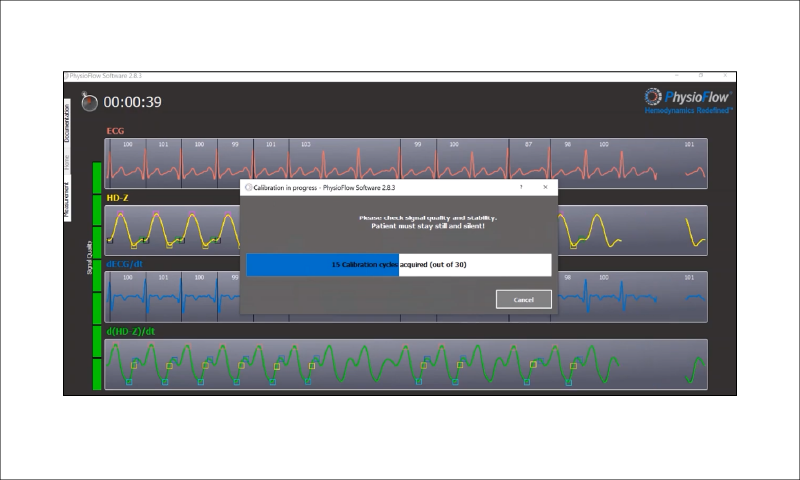 手順4「キャリブレーションを実施する」