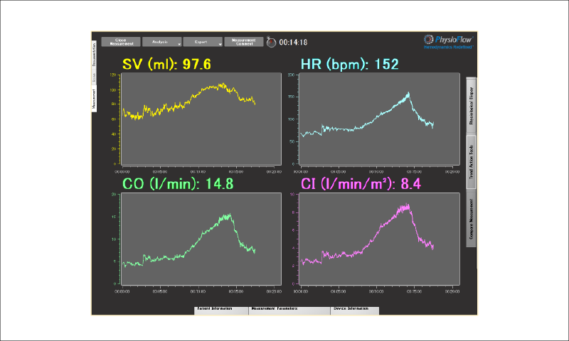 手順8「リアルタイムモニタリングを開始する」
